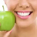 How Diet Impacts Your Teeth Foods to Embrace & Avoid