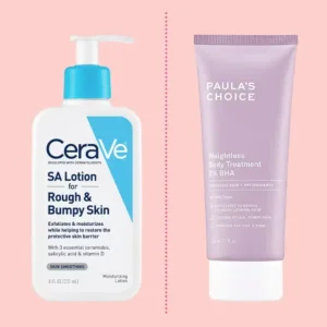 KP Exfoliating Lotion Explained How to Treat Keratosis Pilaris Effectively