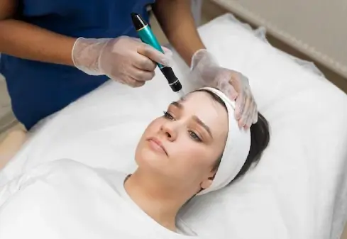 Revolutionizing Complexion Erbium Laser Treatments at Advantage Skin Clinic