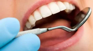 Signs Your Mouth Is Telling You Something About Your Health