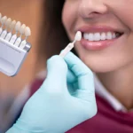 Understanding the Risks and Benefits of Dental Veneers