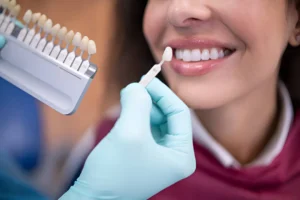 Understanding the Risks and Benefits of Dental Veneers