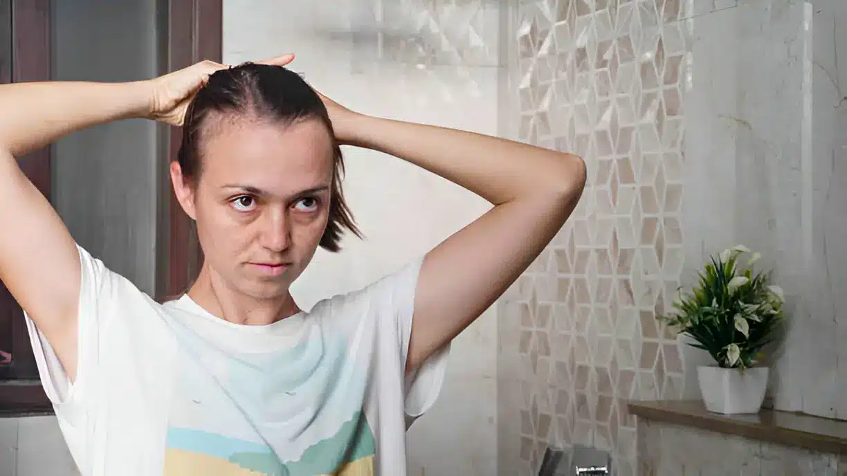 Dealing with Hair Thinning: Practical Advice and Options