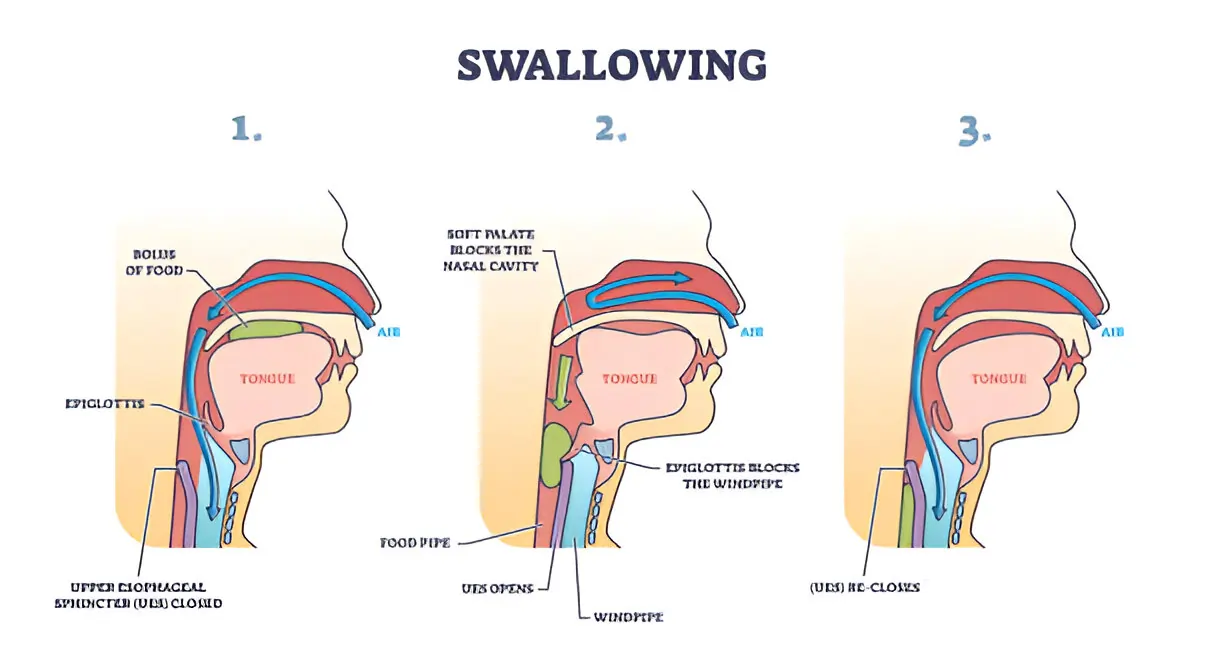 Swallowing Disorders Explained: A Guide for Patients and Caregivers