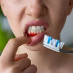 Bleeding Gums After Brushing Here's When You Need Periodontal Treatment